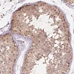 Merck Anti-NUDT10 antibody produced in rabbit