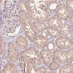 Merck Anti-C10orf128 antibody produced in rabbit