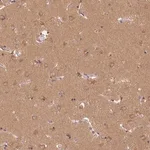 Merck Anti-GDI1 antibody produced in rabbit