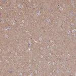 Merck Anti-CLTC antibody produced in rabbit