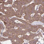 Merck Anti-ITPR2 antibody produced in rabbit