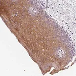 Merck Anti-KRT6A antibody produced in rabbit
