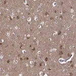 Merck Anti-TARBP2 antibody produced in rabbit