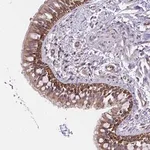Merck Anti-CCDC122 antibody produced in rabbit