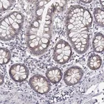 Merck Anti-TRIM60 antibody produced in rabbit