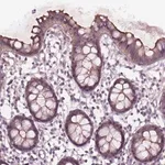 Merck Anti-TCHP antibody produced in rabbit