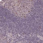 Merck Anti-KIFC1 antibody produced in rabbit