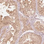 Merck Anti-UBE2L3 antibody produced in rabbit