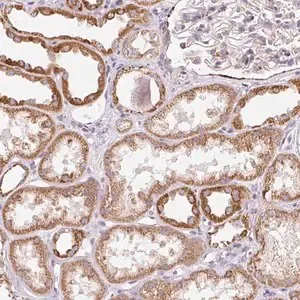 Merck Anti-GIPC2 antibody produced in rabbit