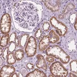 Merck Anti-TRPV5 antibody produced in rabbit