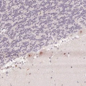 Merck Anti-KDM4D antibody produced in rabbit