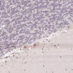 Merck Anti-KDM4D antibody produced in rabbit