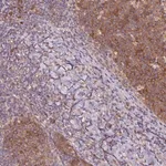 Merck Anti-RRM1 antibody produced in rabbit
