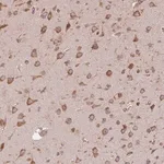 Merck Anti-EIF2S1 antibody produced in rabbit