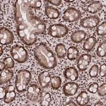 Merck Anti-AMER1 antibody produced in rabbit