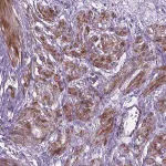 Merck Anti-PFKFB4 antibody produced in rabbit