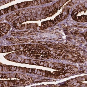Merck Anti-TM6SF2 antibody produced in rabbit