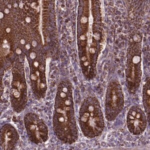 Merck Anti-PIBF1 antibody produced in rabbit