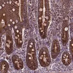 Merck Anti-PIBF1 antibody produced in rabbit