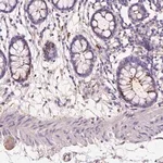 Merck Anti-GDPD5 antibody produced in rabbit