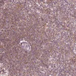 Merck Anti-ADAM33 antibody produced in rabbit