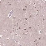 Merck Anti-ISLR2 antibody produced in rabbit