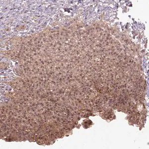 Merck Anti-PARP3 antibody produced in rabbit