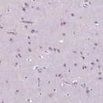 Merck Anti-ZNF853 antibody produced in rabbit