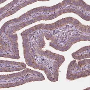 Merck Anti-GEMIN4 antibody produced in rabbit