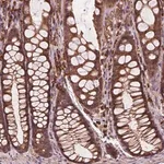 Merck Anti-CCDC71L antibody produced in rabbit