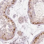 Merck Anti-ERF antibody produced in rabbit