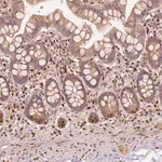 Merck Anti-TBC1D17 antibody produced in rabbit