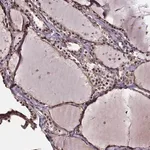 Merck Anti-DDIT3 antibody produced in rabbit