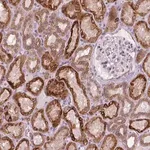 Merck Anti-CTC-534A2.2 antibody produced in rabbit