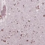 Merck Anti-PIP4K2A antibody produced in rabbit