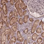 Merck Anti-ZNF879 antibody produced in rabbit