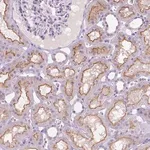 Merck Anti-MMP11 antibody produced in rabbit
