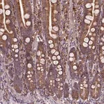 Merck Anti-MAPK8IP3 antibody produced in rabbit