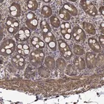 Merck Anti-PCID2 antibody produced in rabbit