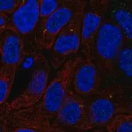 Merck Anti-TTC6 antibody produced in rabbit