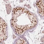 Merck Anti-IFFO1 antibody produced in rabbit