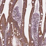 Merck Anti-PYCRL antibody produced in rabbit
