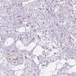 Merck Anti-DCC antibody produced in rabbit