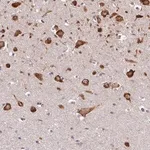 Merck Anti-DENND6A antibody produced in rabbit