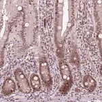 Merck Anti-HMG20B antibody produced in rabbit