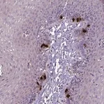 Merck Anti-CCER2 antibody produced in rabbit