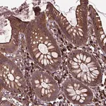 Merck Anti-MYH14 antibody produced in rabbit