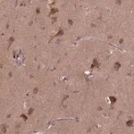 Merck Anti-ST6GALNAC5 antibody produced in rabbit
