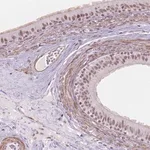 Merck Anti-HOXD4 antibody produced in rabbit