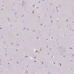 Merck Anti-TMEM169 antibody produced in rabbit